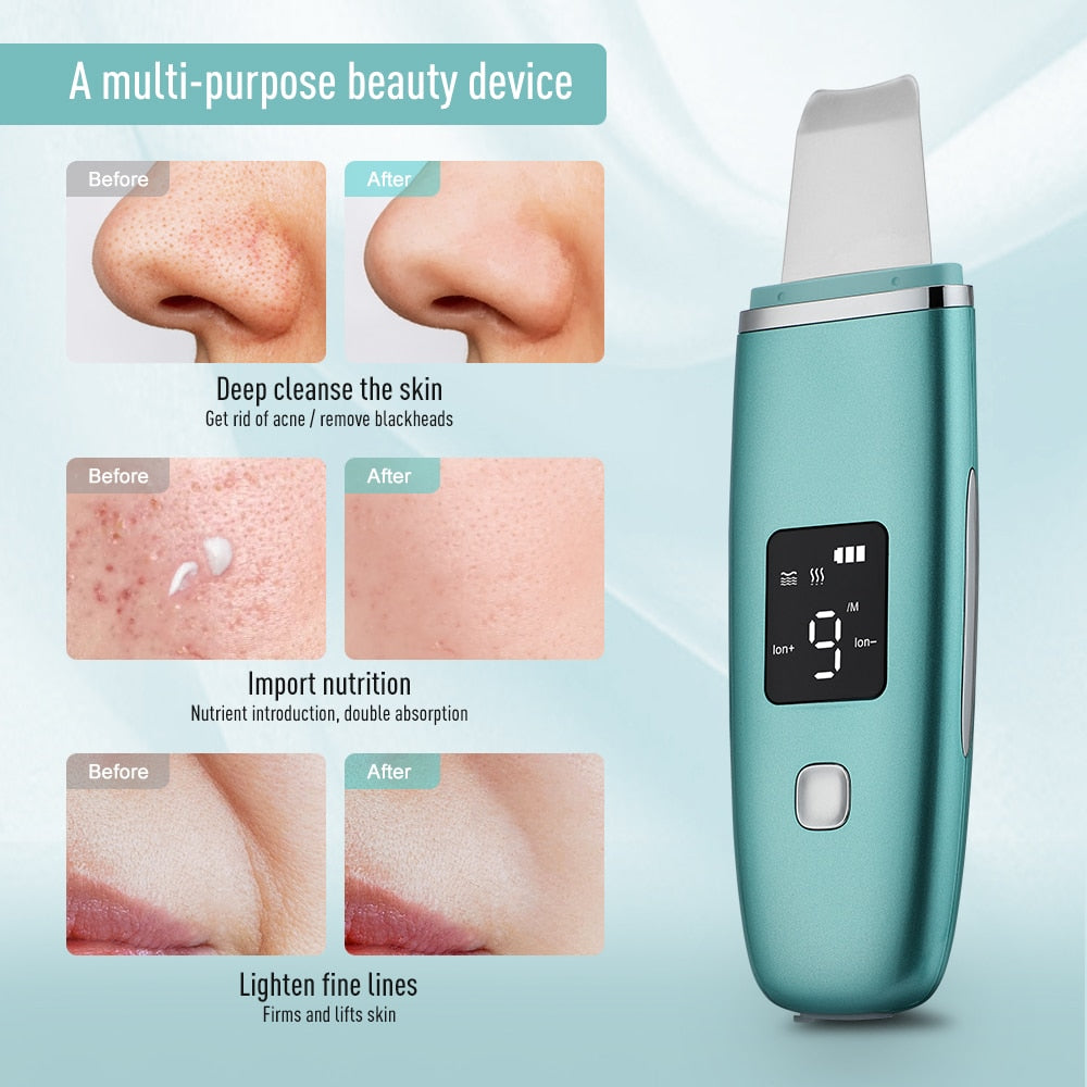 Ultrasonic Skin Scrubber EMS Facial Pore Deep Cleansing