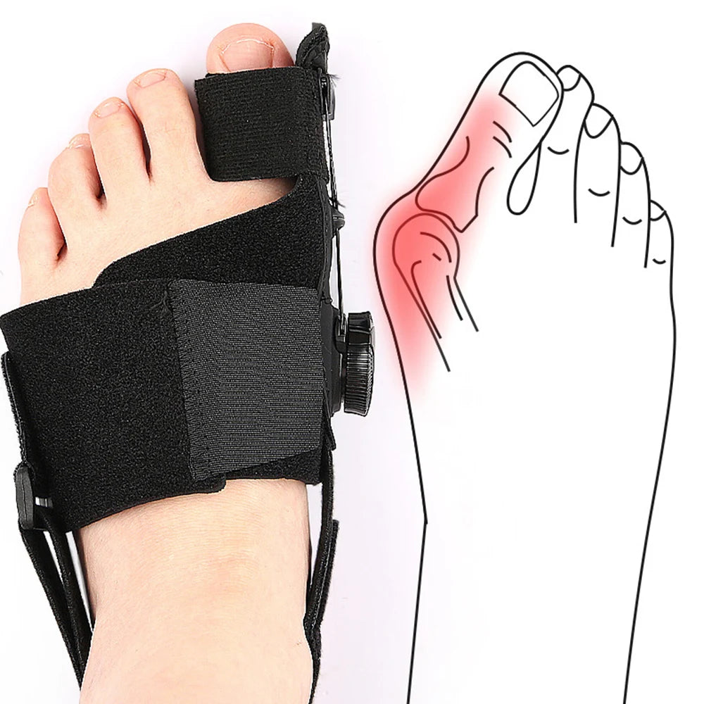 1PC Pain Relief Bunion Corrector Big Toe Straightener Adjustable Hallux Valgus Corrector With Knob Buckle Orthopedic Supplies