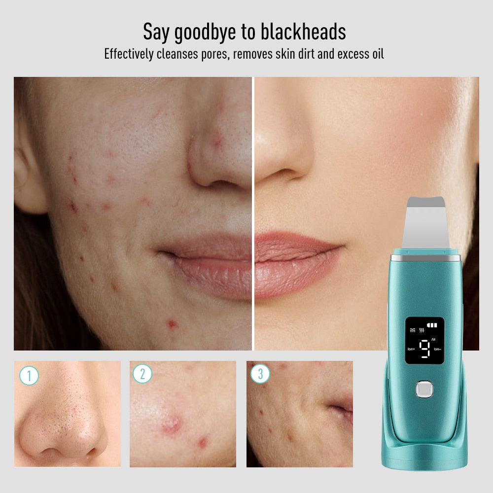 Ultrasonic Skin Scrubber EMS Facial Pore Deep Cleansing