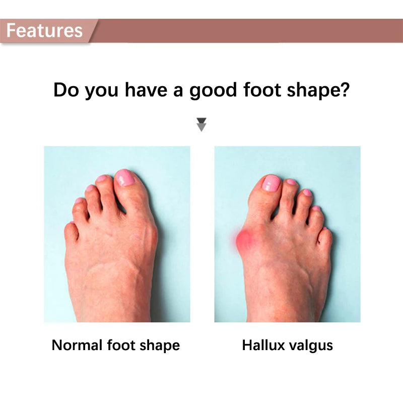 2Pcs=1Pair Toe Separator Hallux Valgus Bunion Corrector Orthotics Feet Bone Thumb Adjuster Correction Pedicure Sock Straightener
