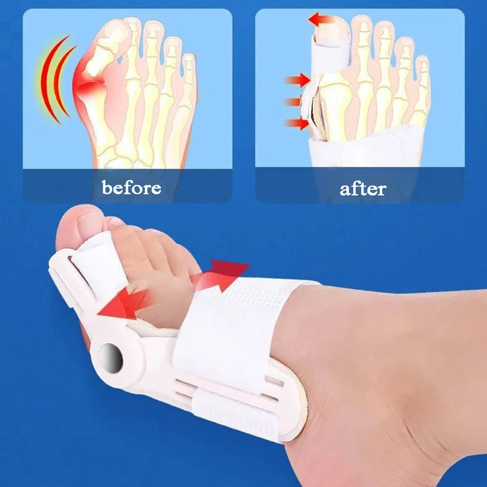 2pcs Foot Pain Relief Hallux Valgus Corrector Big Bone Toe Bunion Splint Straightener Corrector Toe Separator Foot Care Tool New