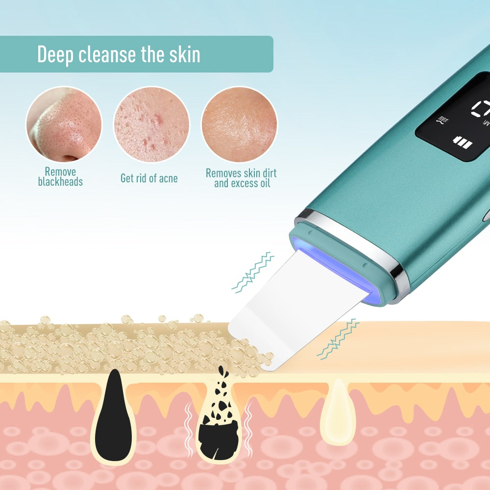 Ultrasonic Skin Scrubber EMS Facial Pore Deep Cleansing