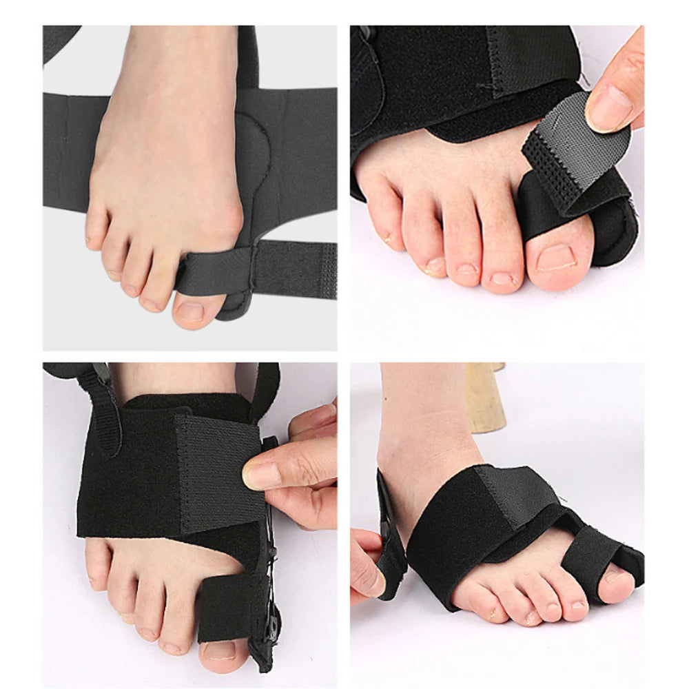 1PC Pain Relief Bunion Corrector Big Toe Straightener Adjustable Hallux Valgus Corrector With Knob Buckle Orthopedic Supplies